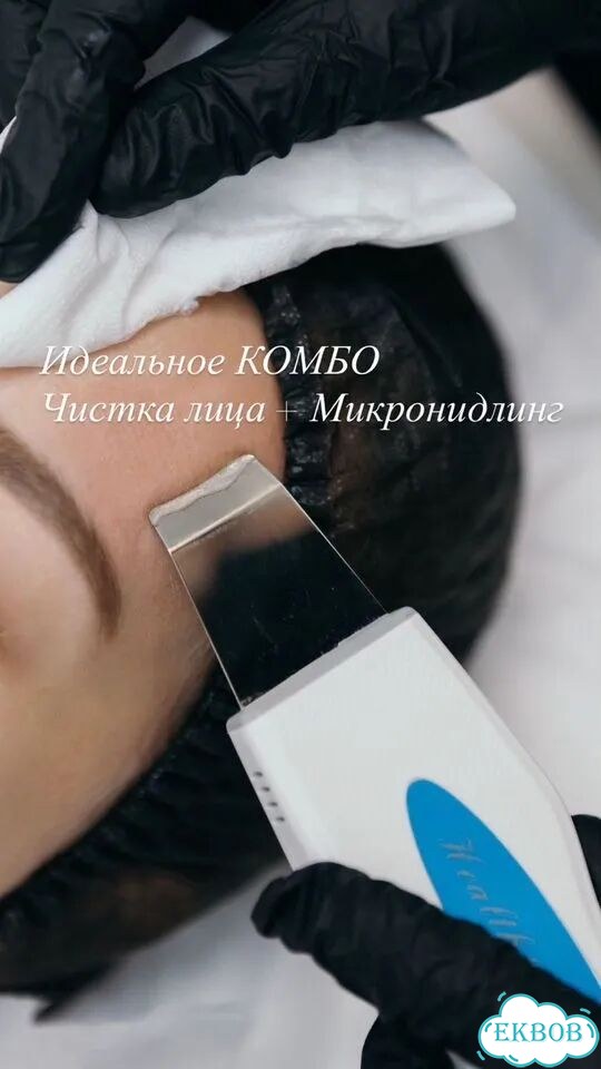 Чистка лица + микронидлинг фото 1