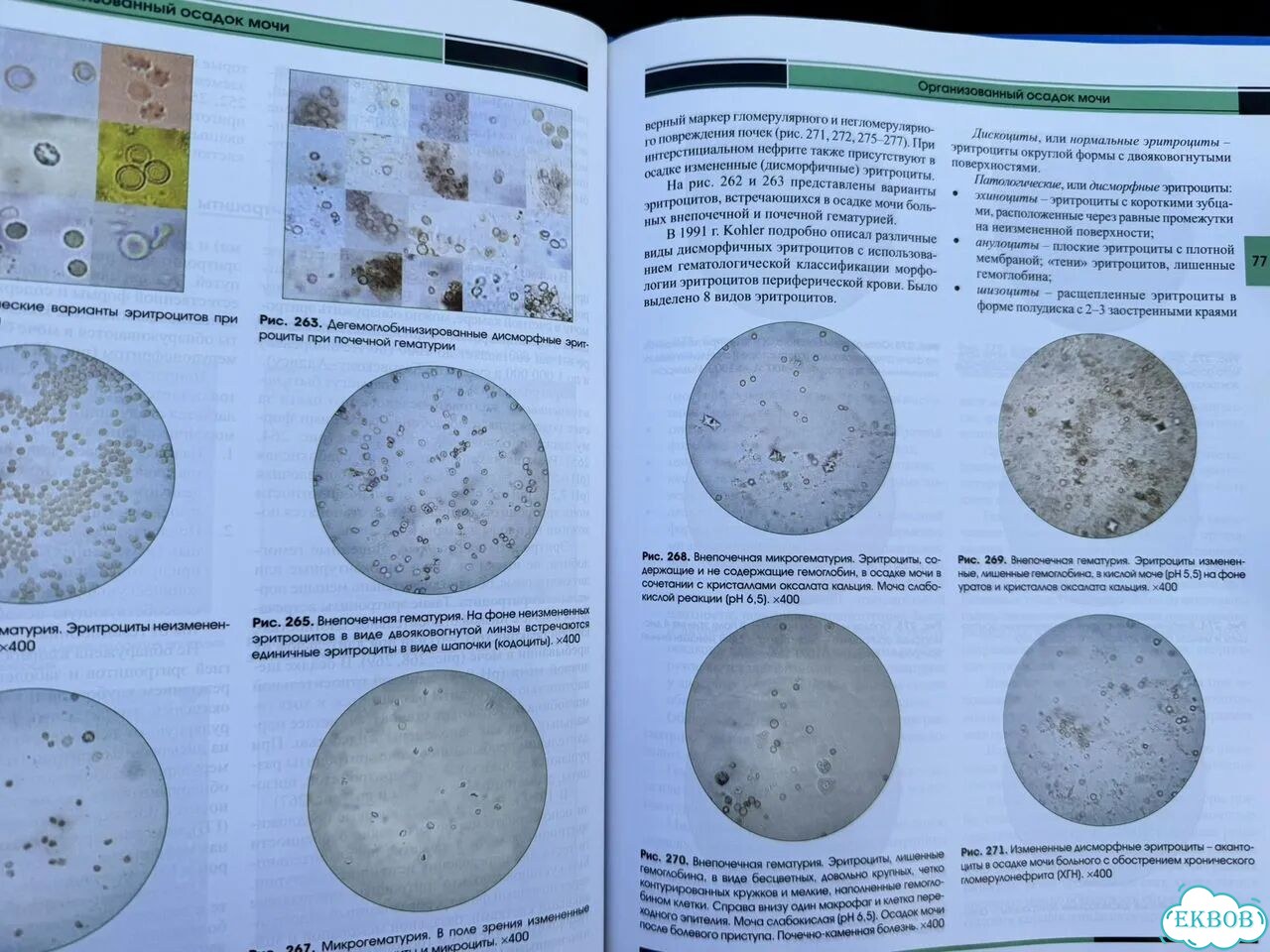 Атлас осадков мочи Миронова фото 4
