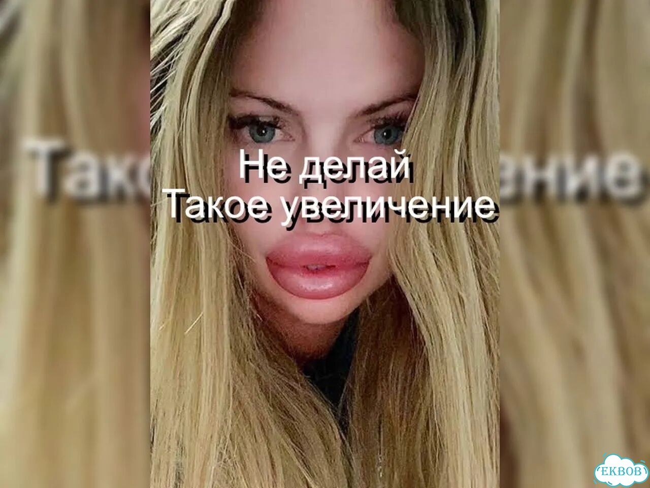 Увеличение губ фото 1